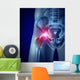 Hip Pain