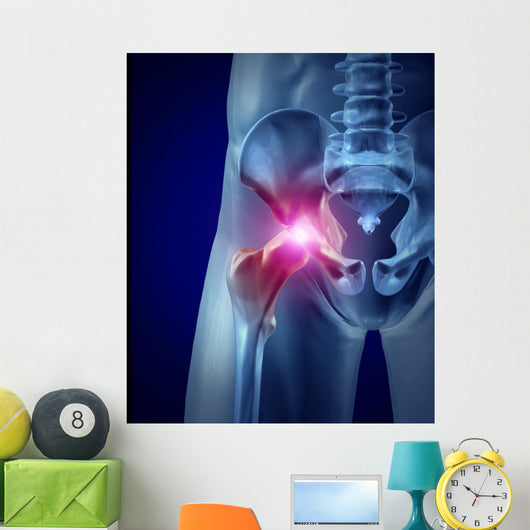 Hip Pain
