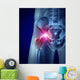 Hip Pain