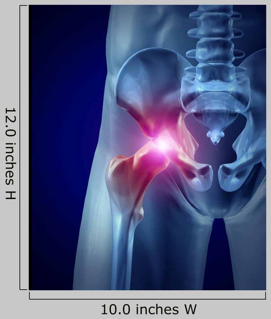Hip Pain