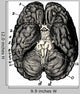 Cerveau Human