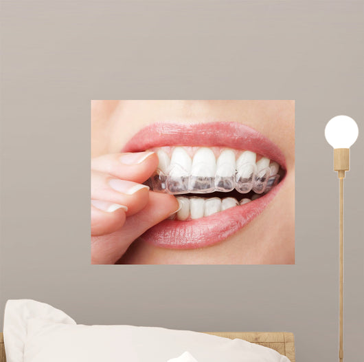 Teeth with Whitening Tray