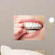 Teeth with Whitening Tray