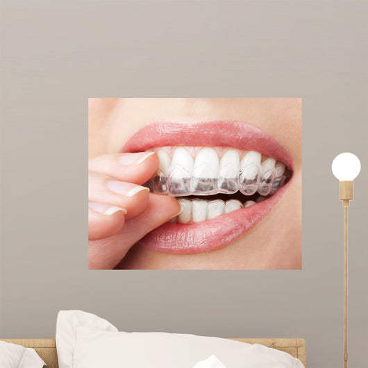 Teeth with Whitening Tray