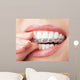 Teeth with Whitening Tray