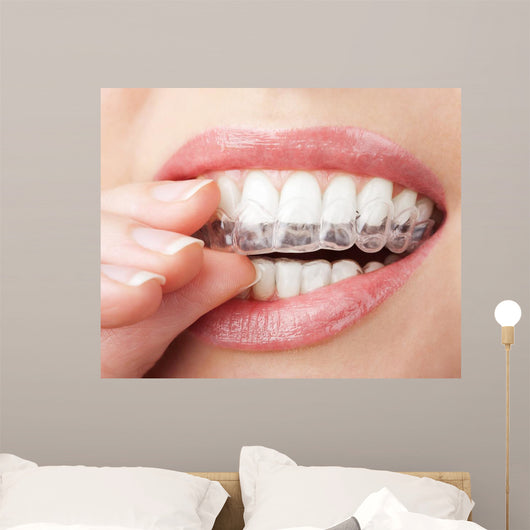 Teeth with Whitening Tray