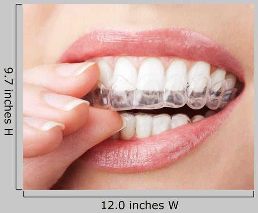 Teeth with Whitening Tray