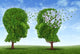 Living with Alzheimers