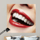 Woman Smile Teeth Whitening Wall Decal