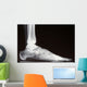 X-ray Wall Decal