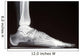 X-ray Wall Decal