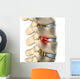 Disc Herniated