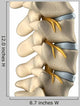 Spinal Nervous System Lateral