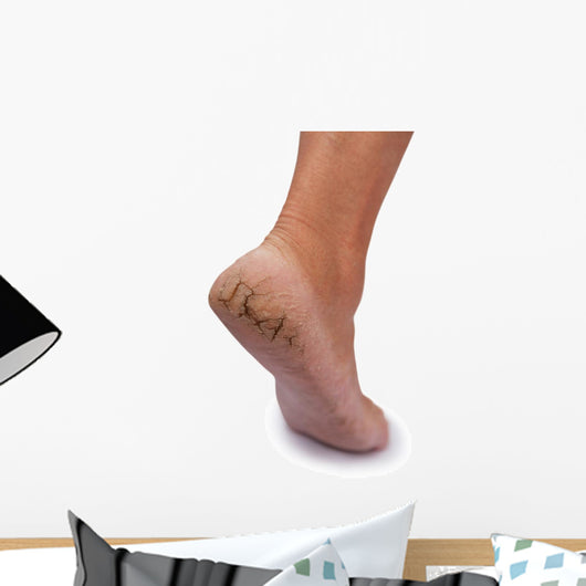 Chapped Heel