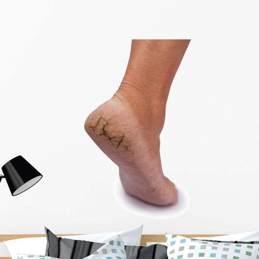 Chapped Heel