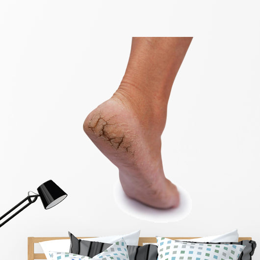 Chapped Heel