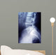 Lumbar Spine X-ray Image