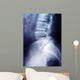 Lumbar Spine X-ray Image