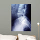 Lumbar Spine X-ray Image