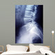 Lumbar Spine X-ray Image
