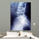 Lumbar Spine X-ray Image