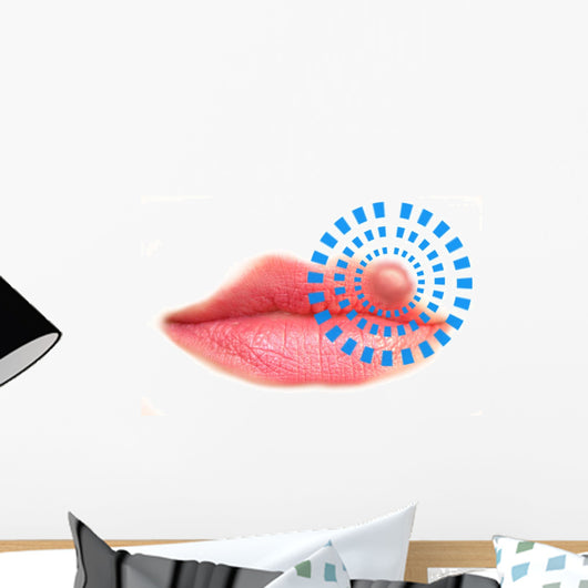 Close up of lips affected by herpes (cold sore) Wall Decal