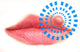 Close up of lips affected by herpes (cold sore) Wall Decal