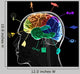 Functional Areas Brain