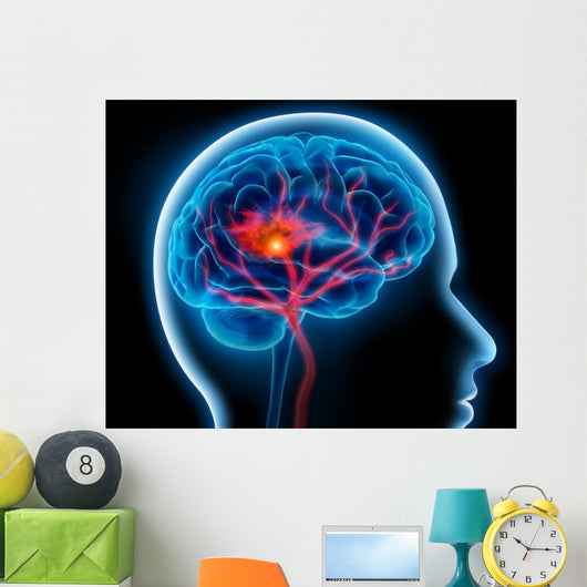 Headache