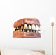 teeth with gums Wall Decal