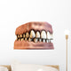 teeth with gums Wall Decal