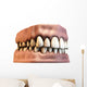 teeth with gums Wall Decal