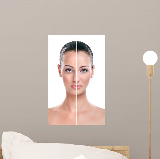 Before and after Skin