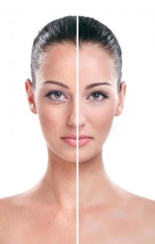 Before and after Skin