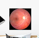 Retina Wall Mural