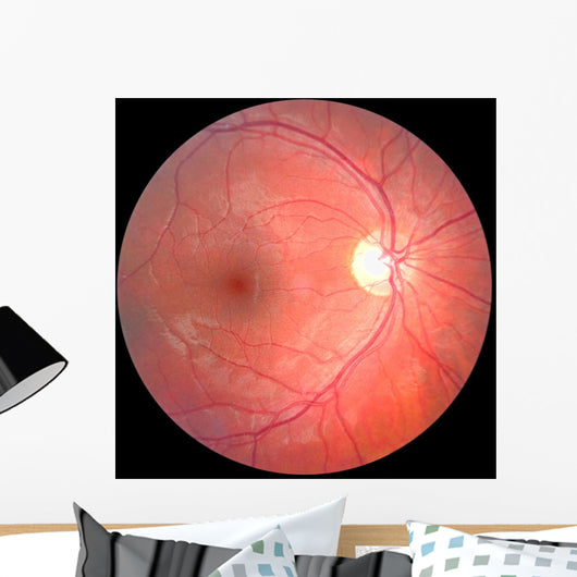 Retina Wall Mural