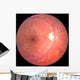 Retina Wall Mural