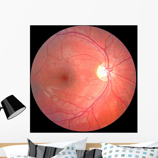 Retina Wall Mural