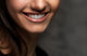 Closeup Beautiful Smile