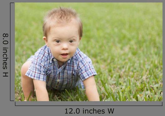 Down Syndrome Child Crawling