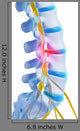 3d Rendered Illustration - Herniated Disk Wall Decal