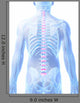 3D Rendered Illustration Intervertebral