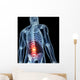 3D Rendered Illustration Backache
