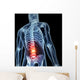 3D Rendered Illustration Backache