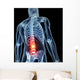 3D Rendered Illustration Backache