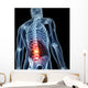 3D Rendered Illustration Backache