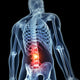 3D Rendered Illustration Backache