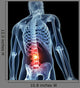 3D Rendered Illustration Backache