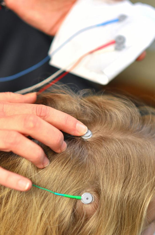 Electrodes for Neurofeedback Baby