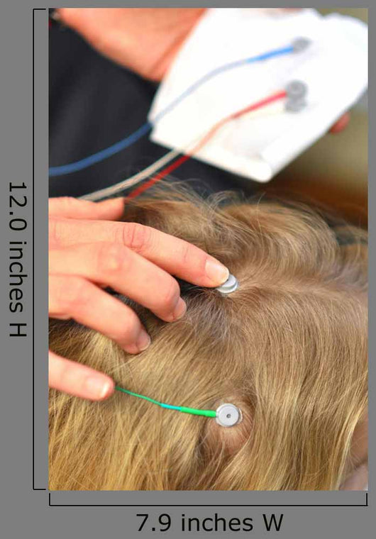 Electrodes for Neurofeedback Baby